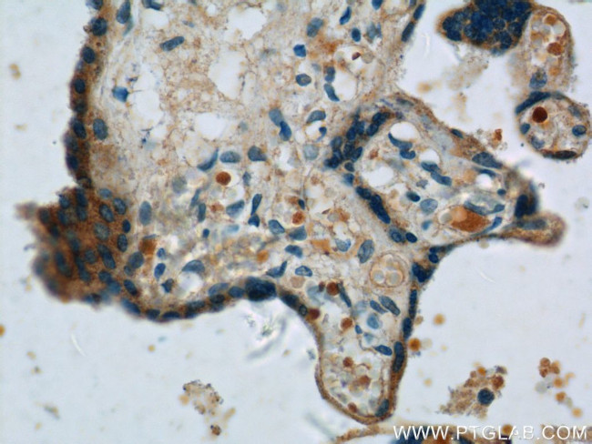 ZFP36L1 Antibody in Immunohistochemistry (Paraffin) (IHC (P))