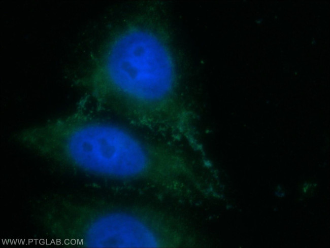 ZFP36L1 Antibody in Immunocytochemistry (ICC/IF)