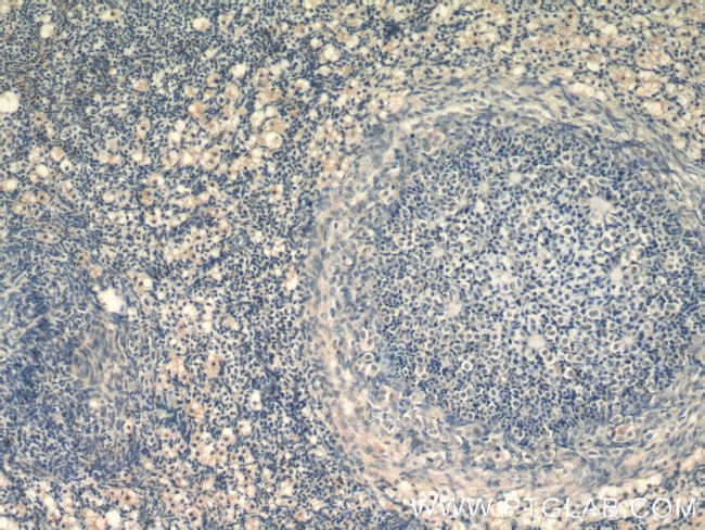 ZFP36L1 Antibody in Immunohistochemistry (Paraffin) (IHC (P))