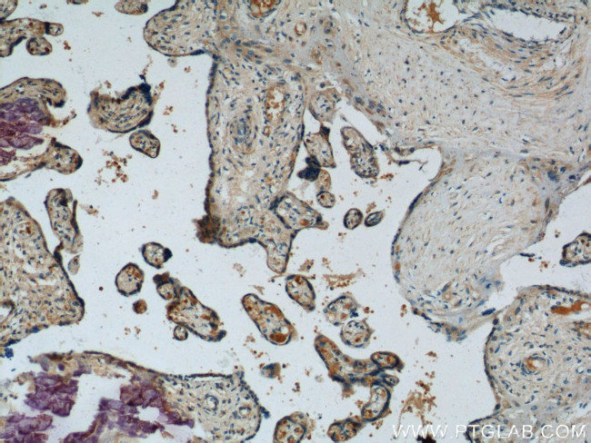 ZFP36L1 Antibody in Immunohistochemistry (Paraffin) (IHC (P))