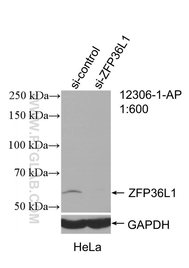 ZFP36L1 Antibody in Western Blot (WB)