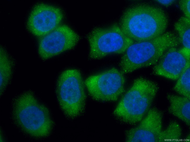 GEMIN6 Antibody in Immunocytochemistry (ICC/IF)