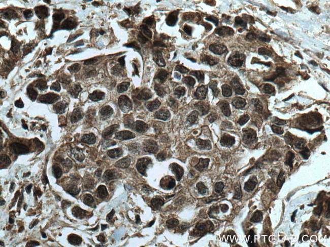 GEMIN6 Antibody in Immunohistochemistry (Paraffin) (IHC (P))