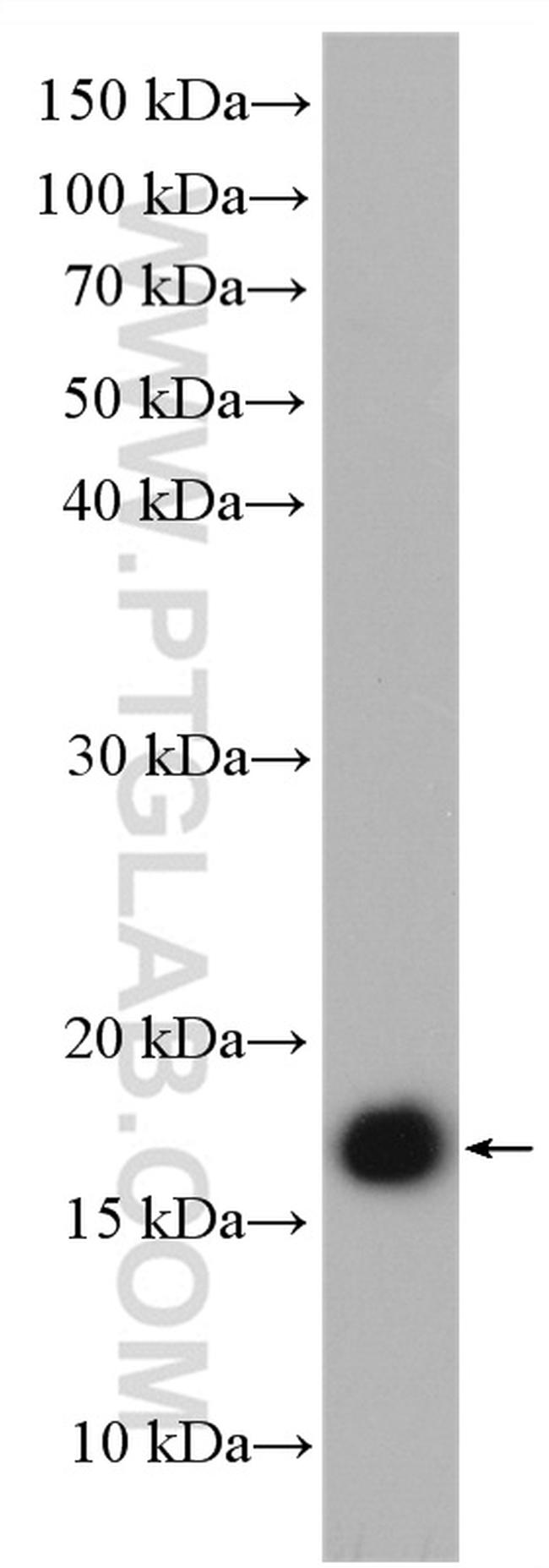 GEMIN6 Antibody in Western Blot (WB)