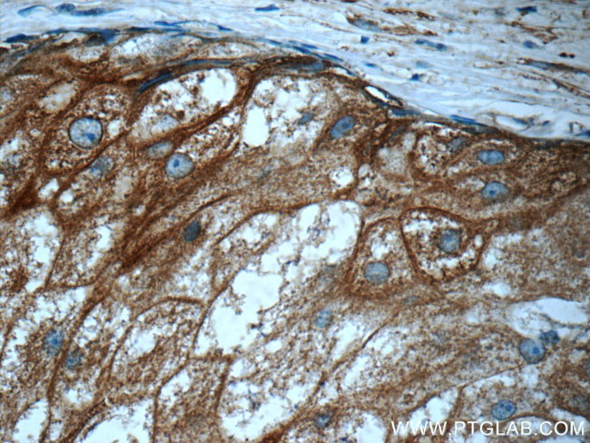 RAB3D Antibody in Immunohistochemistry (Paraffin) (IHC (P))