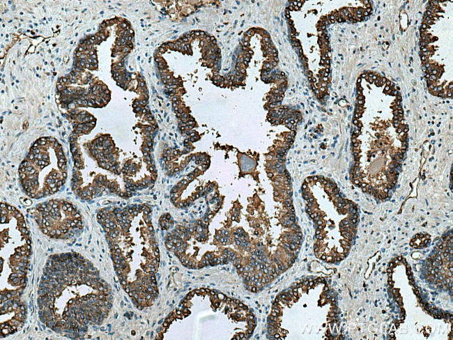 RAB3D Antibody in Immunohistochemistry (Paraffin) (IHC (P))