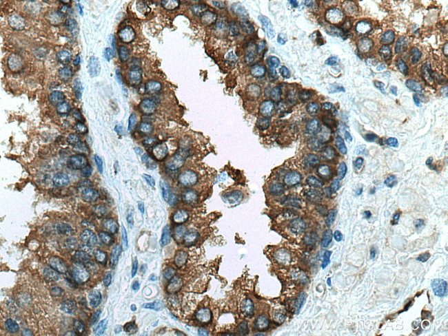 RAB3D Antibody in Immunohistochemistry (Paraffin) (IHC (P))