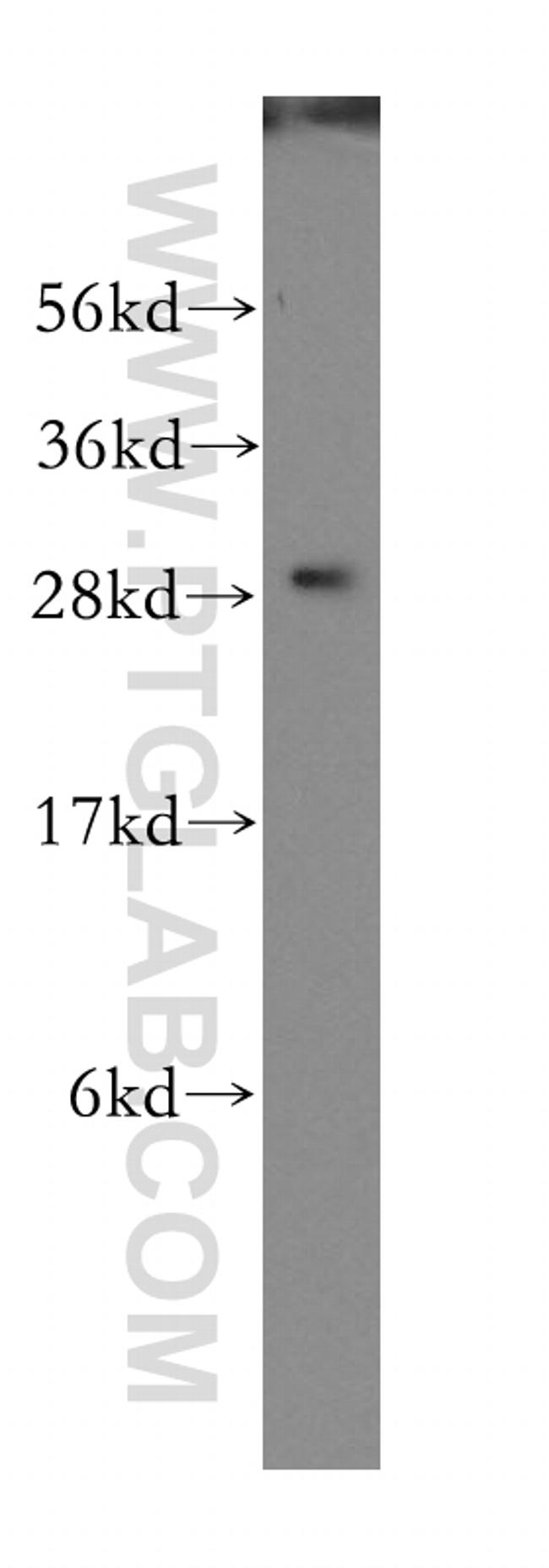 RAB3D Antibody in Western Blot (WB)