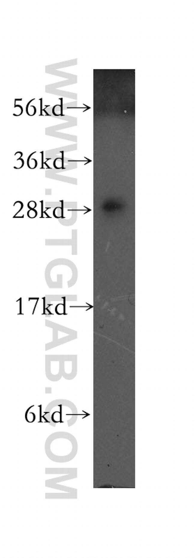 RAB3D Antibody in Western Blot (WB)