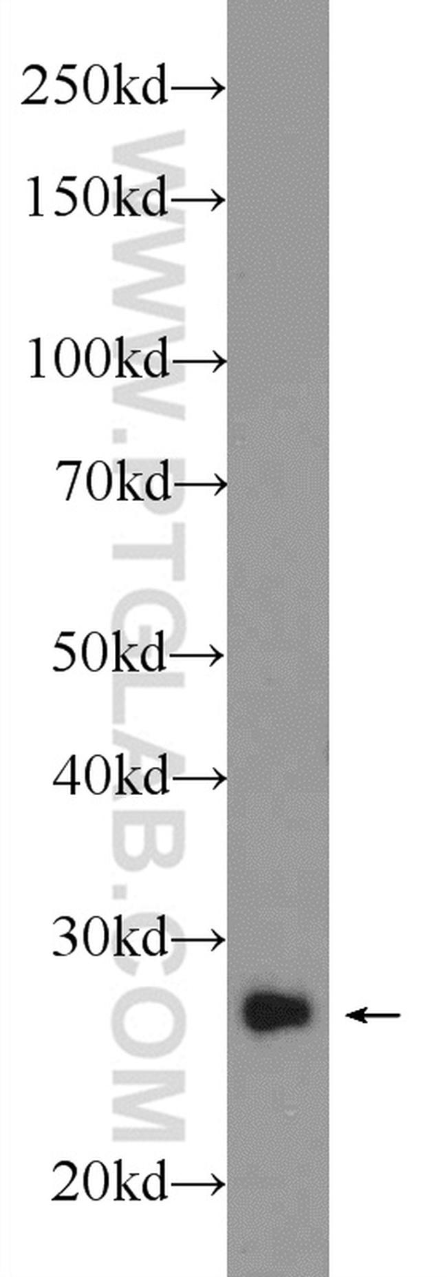 RAB3D Antibody in Western Blot (WB)