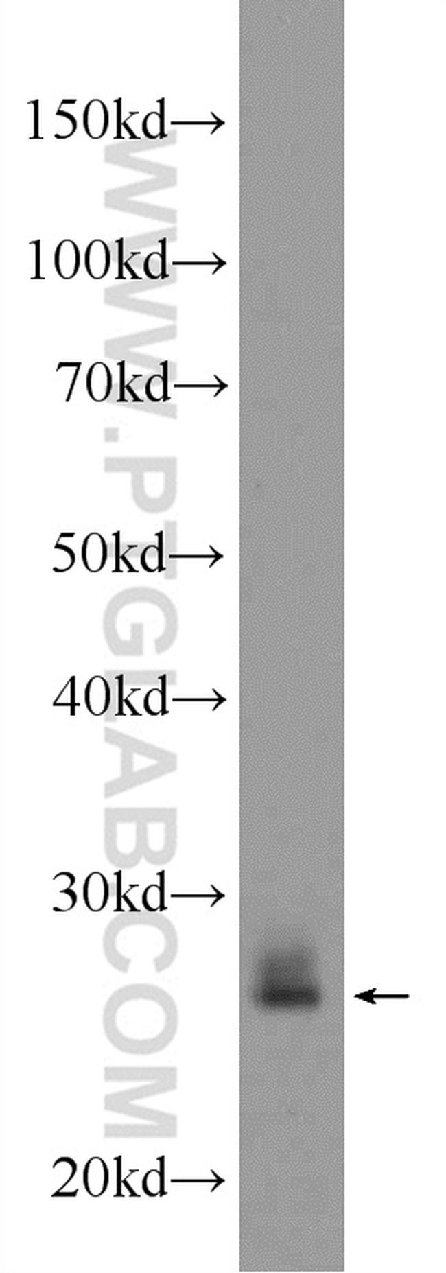 RAB3D Antibody in Western Blot (WB)