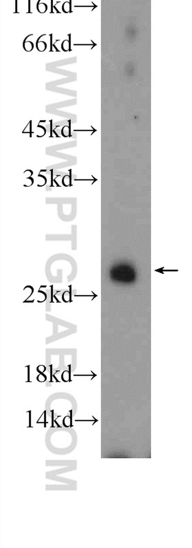 RAB3D Antibody in Western Blot (WB)