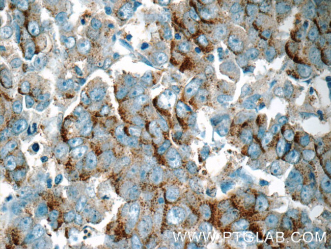 RAB3D Antibody in Immunohistochemistry (Paraffin) (IHC (P))