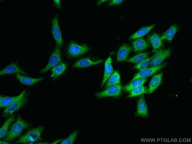 RAB3IP/Rabin8 Antibody in Immunocytochemistry (ICC/IF)