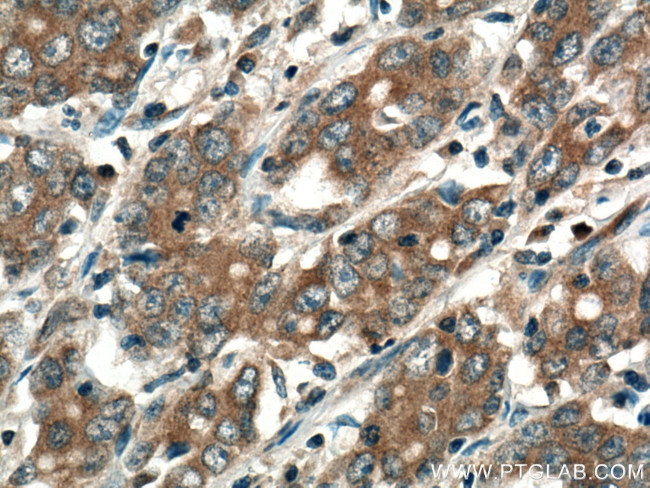 RAB3IP/Rabin8 Antibody in Immunohistochemistry (Paraffin) (IHC (P))