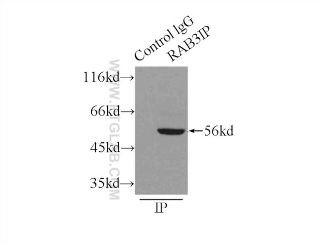 RAB3IP/Rabin8 Antibody in Immunoprecipitation (IP)