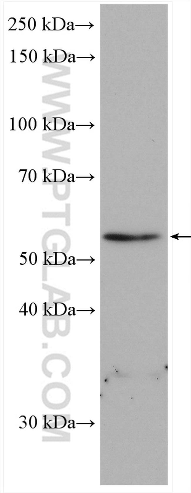 RAB3IP/Rabin8 Antibody in Western Blot (WB)