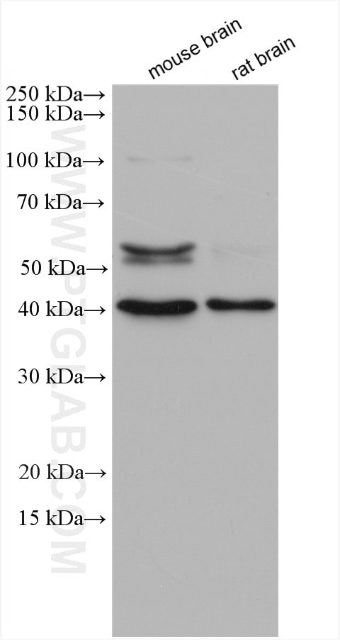 RAB3IP/Rabin8 Antibody in Western Blot (WB)