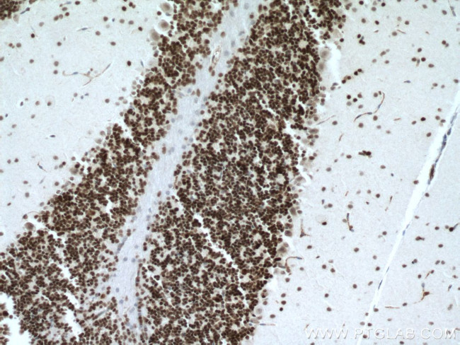 PAX6 Antibody in Immunohistochemistry (Paraffin) (IHC (P))