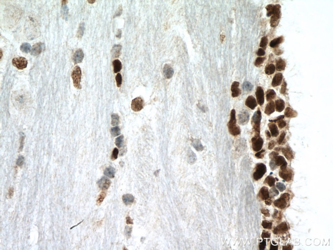 PAX6 Antibody in Immunohistochemistry (Paraffin) (IHC (P))