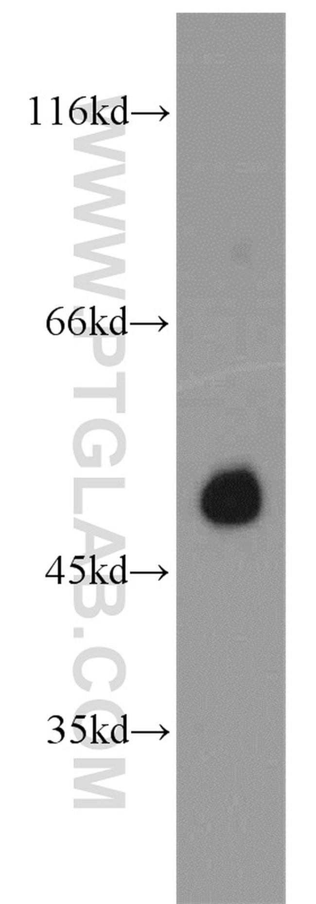 PAX6 Antibody in Western Blot (WB)