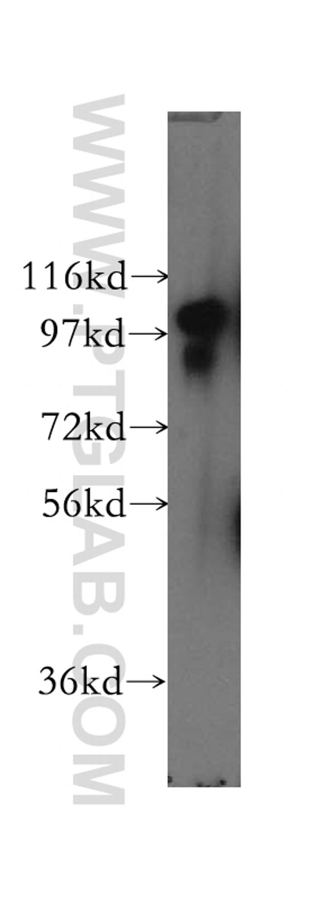 SCYL2 Antibody in Western Blot (WB)