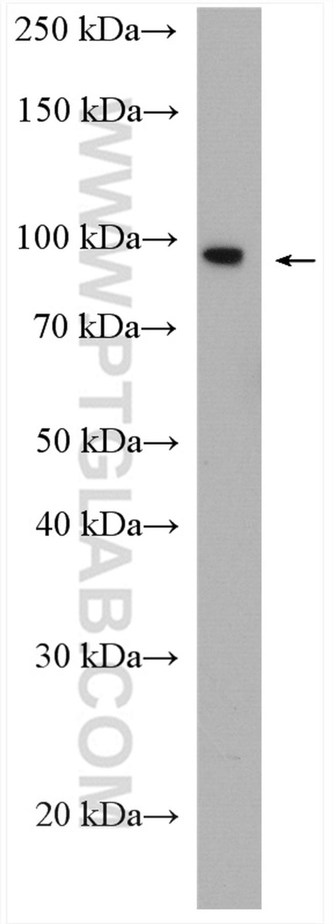 SCYL2 Antibody in Western Blot (WB)