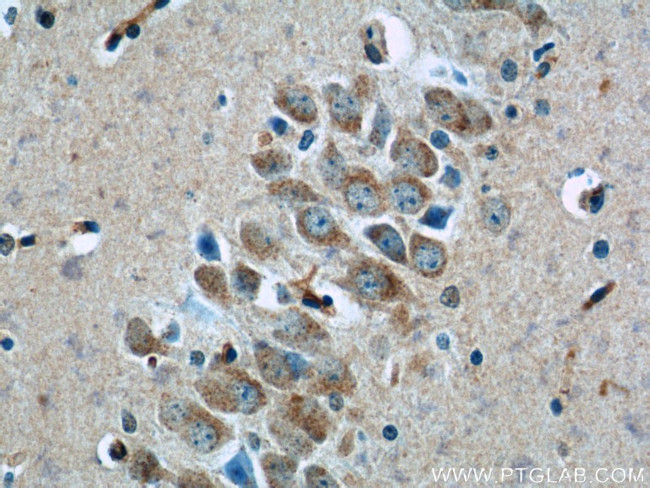 TWSG1 Antibody in Immunohistochemistry (Paraffin) (IHC (P))