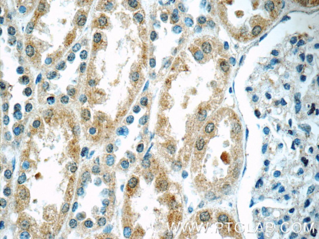 TWSG1 Antibody in Immunohistochemistry (Paraffin) (IHC (P))