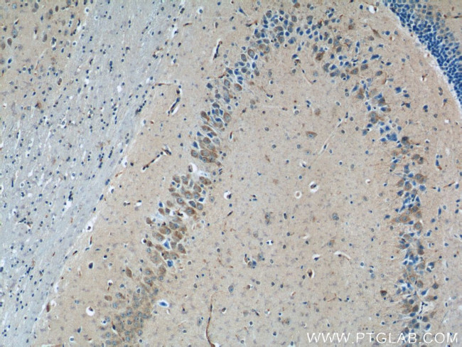 TWSG1 Antibody in Immunohistochemistry (Paraffin) (IHC (P))