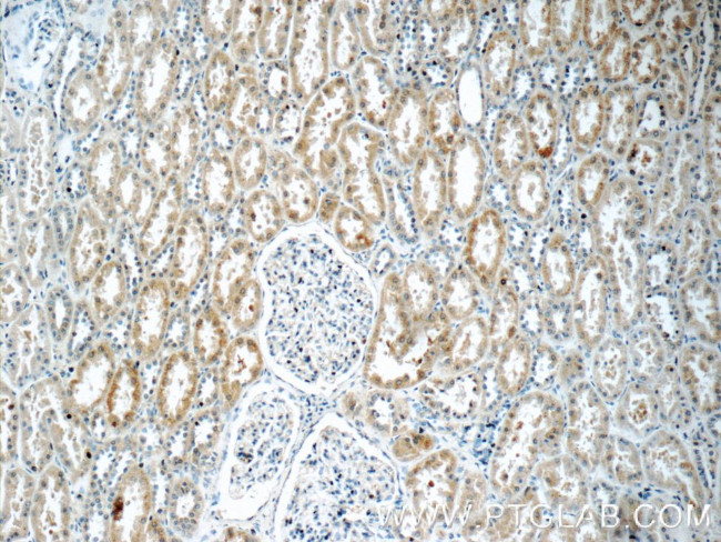 TWSG1 Antibody in Immunohistochemistry (Paraffin) (IHC (P))