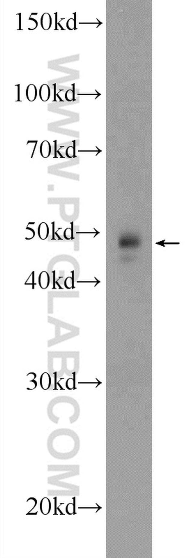 TWSG1 Antibody in Western Blot (WB)