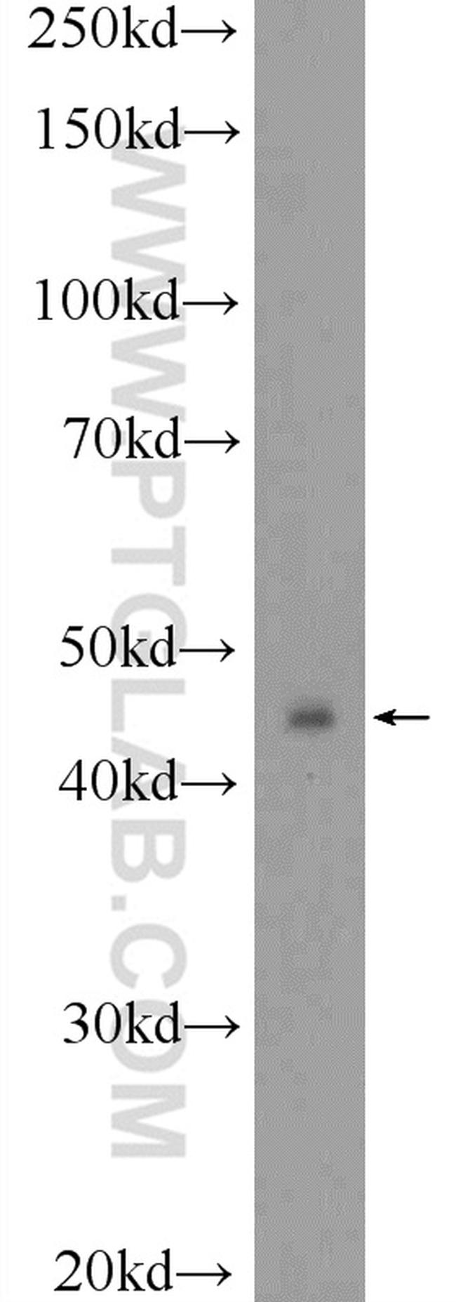 TWSG1 Antibody in Western Blot (WB)