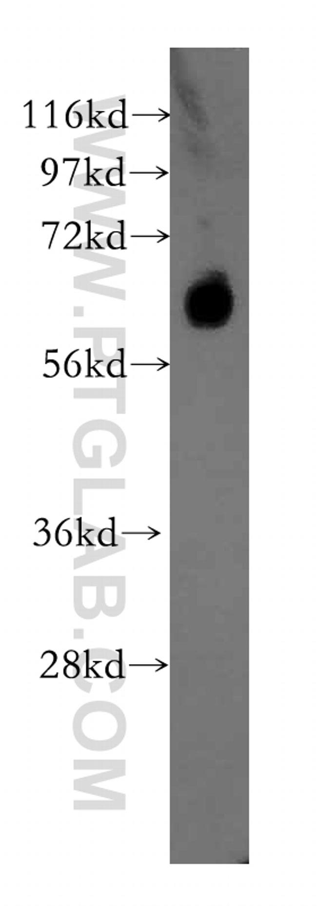 ARSG Antibody in Western Blot (WB)