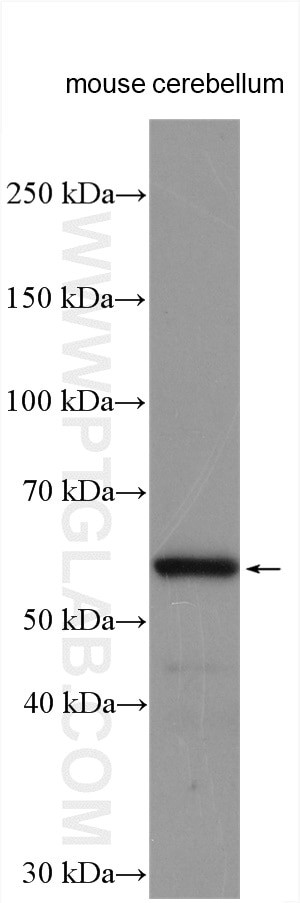 ARSG Antibody in Western Blot (WB)