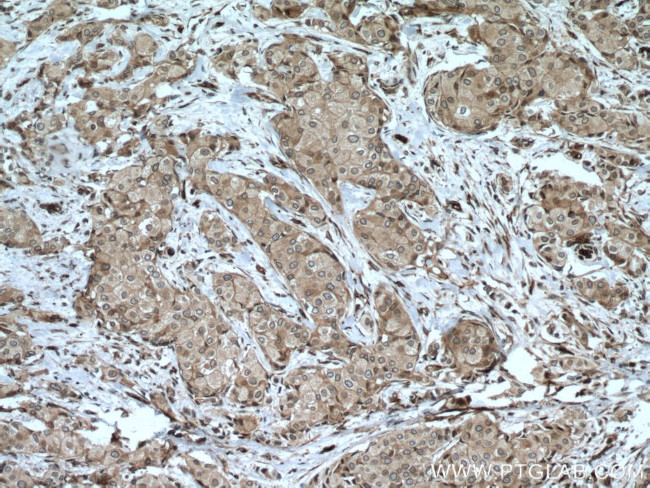 NUP98-NUP96 Antibody in Immunohistochemistry (Paraffin) (IHC (P))