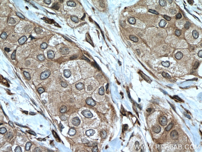 NUP98-NUP96 Antibody in Immunohistochemistry (Paraffin) (IHC (P))