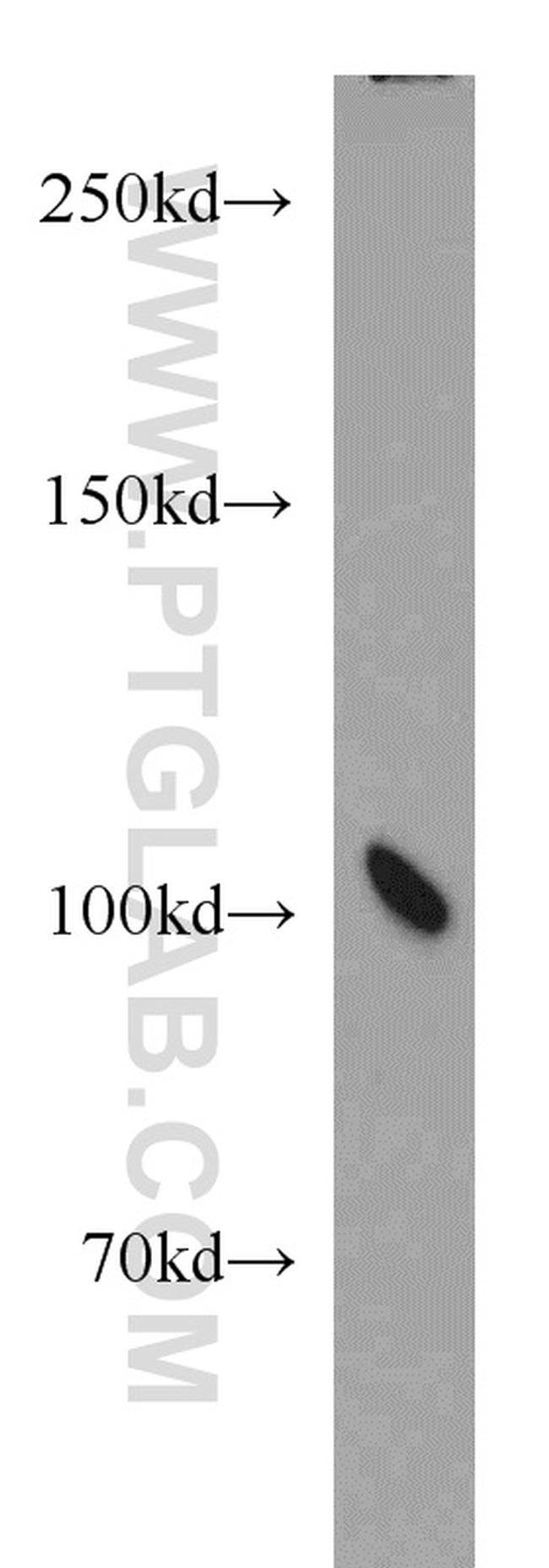 NUP98-NUP96 Antibody in Western Blot (WB)