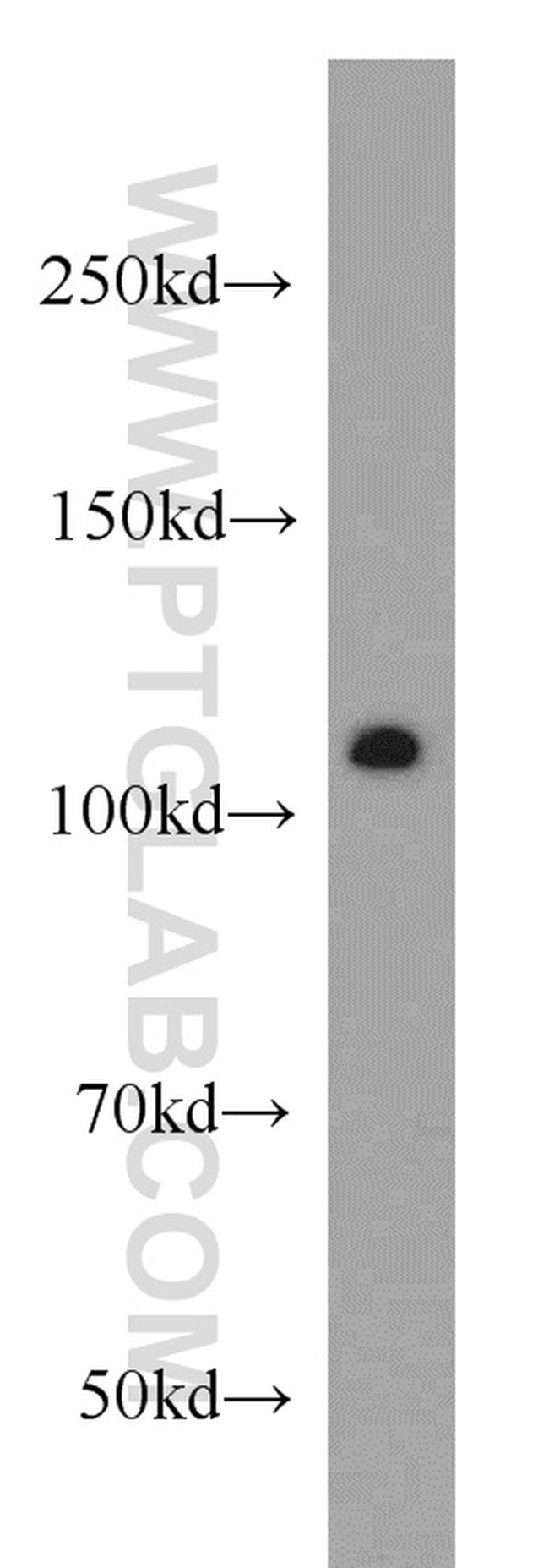 NUP98-NUP96 Antibody in Western Blot (WB)