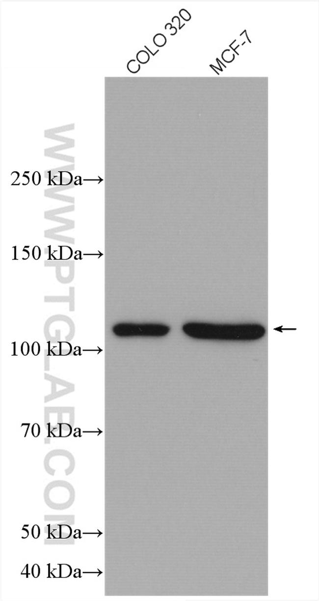 NUP98-NUP96 Antibody in Western Blot (WB)