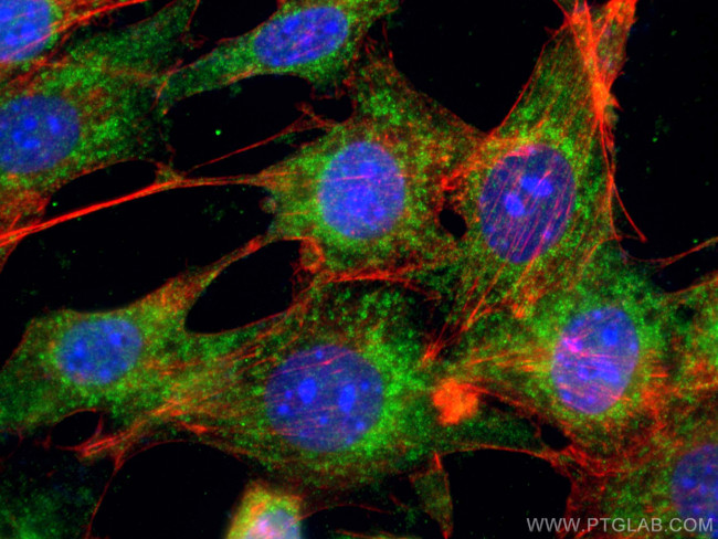 TAK1 Antibody in Immunocytochemistry (ICC/IF)