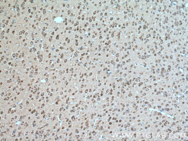 TAK1 Antibody in Immunohistochemistry (Paraffin) (IHC (P))