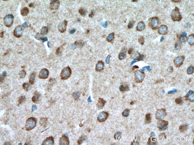 TAK1 Antibody in Immunohistochemistry (Paraffin) (IHC (P))