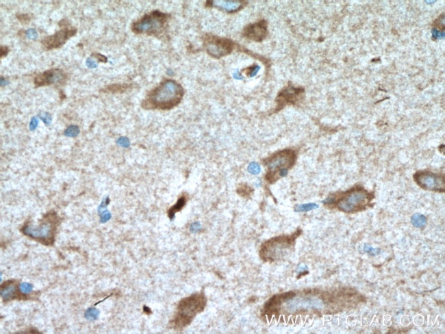 TAK1 Antibody in Immunohistochemistry (Paraffin) (IHC (P))