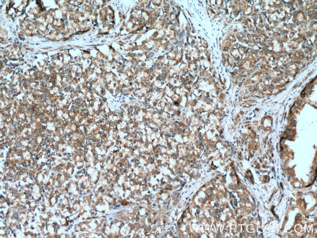 TAK1 Antibody in Immunohistochemistry (Paraffin) (IHC (P))