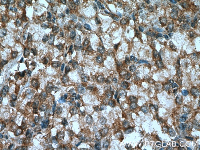 TAK1 Antibody in Immunohistochemistry (Paraffin) (IHC (P))