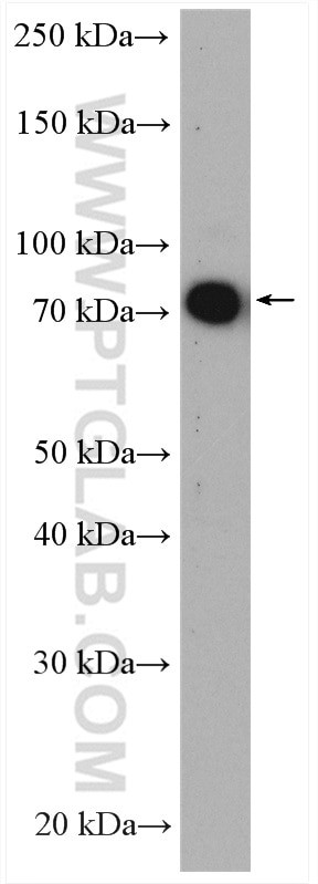 TAK1 Antibody in Western Blot (WB)