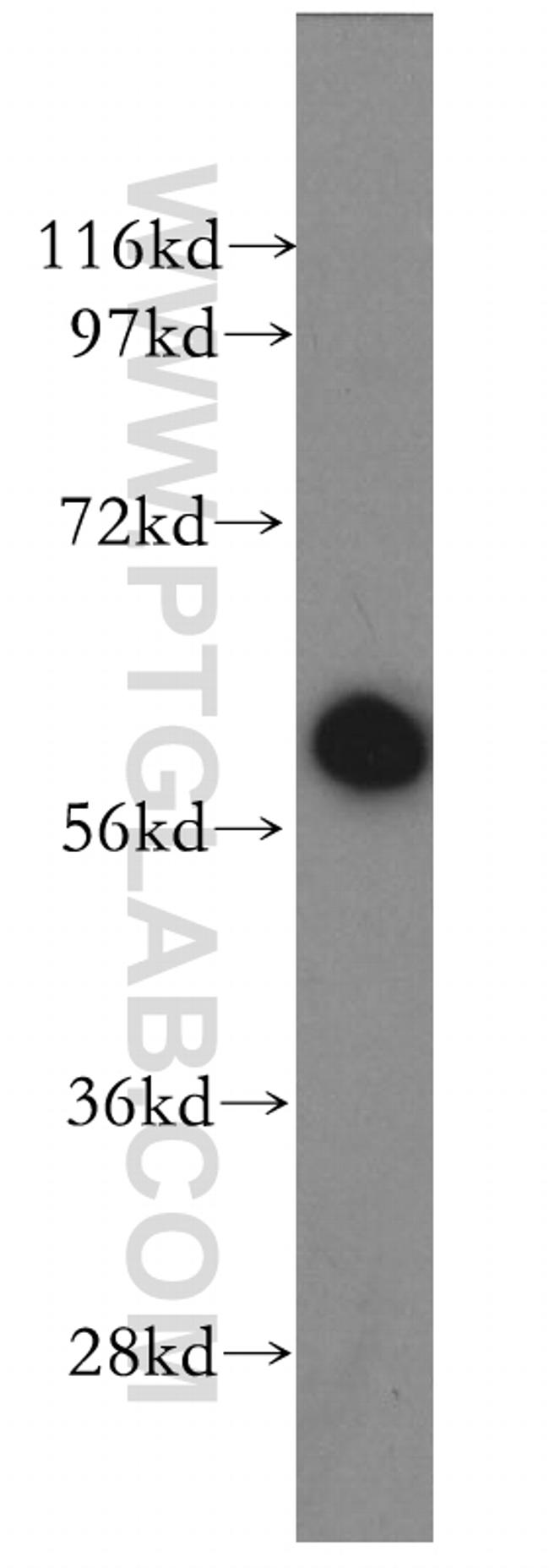 TAK1 Antibody in Western Blot (WB)