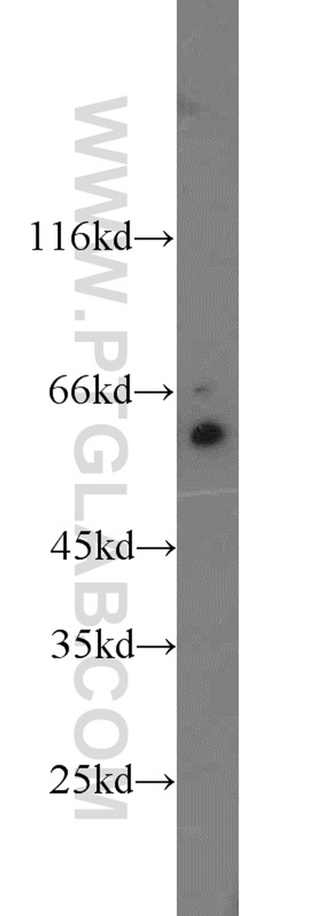 TAK1 Antibody in Western Blot (WB)