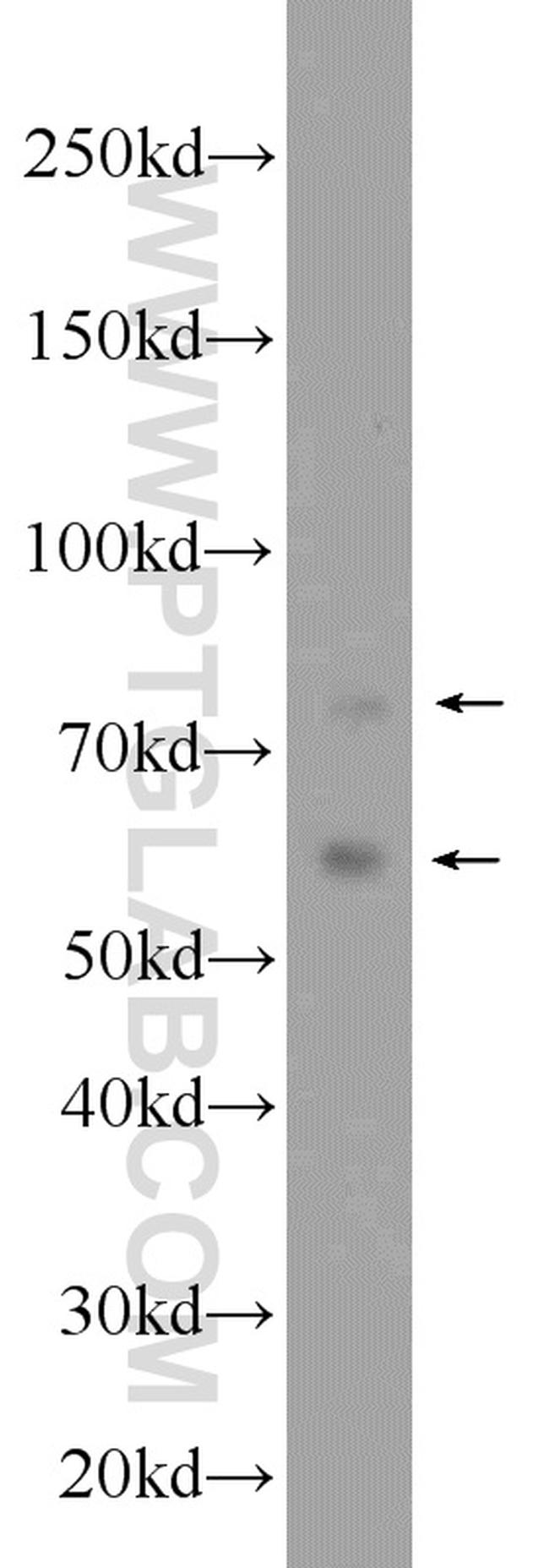 TAK1 Antibody in Western Blot (WB)